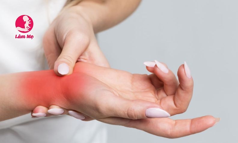 Sau sinh bị đau cổ tay: nguyên nhân và cách khắc phục hiệu quả