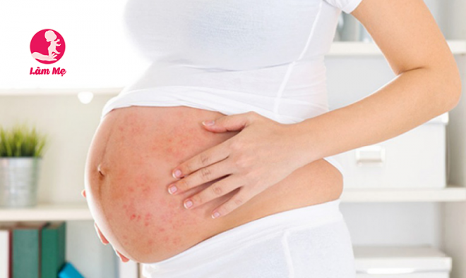 Khi mang thai bị nóng trong bụng có nguy hiểm không?
